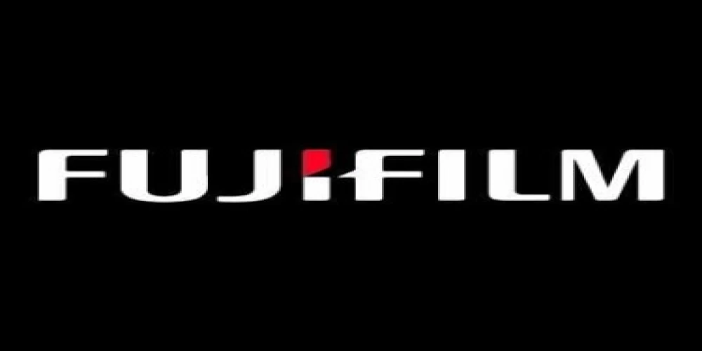 Fujifilm India donates digital x-ray machines worth Rs 1.2 crore Fujifilm India donates digital x-ray machines worth Rs 1.2 crore